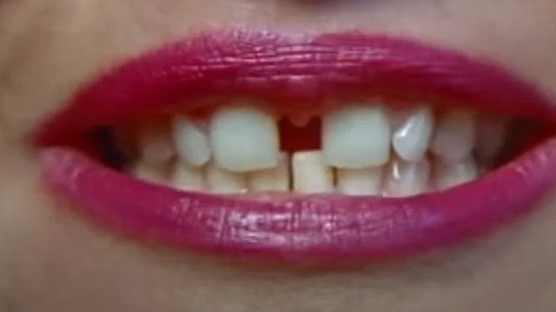 Gap-Toothed Women screenshot 2
